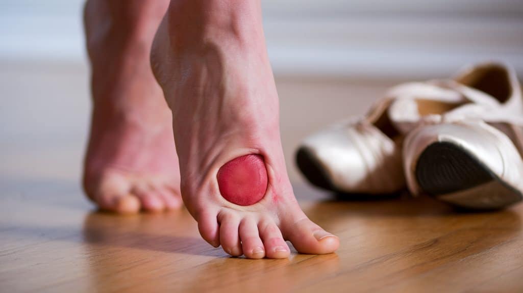 Morton Neurom 1 fußgesundheit hochriskantes Schuhwerk und Aktivitäten
