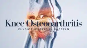 Kniegelenksarthrose