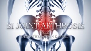 Sakroiliakalgelenk-Arthrose