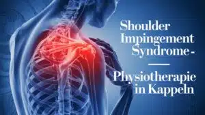Schulter-Impingement-Syndrom
