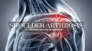Schultergelenk-Knorpeldegeneration