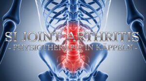 Iliosakralgelenk-Arthritis