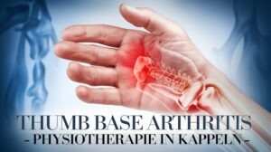 Daumensattelgelenksarthrose