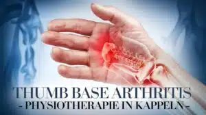 Daumensattelgelenksarthrose