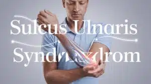 Ulnarnervkompressionssyndrom