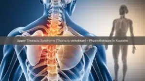oberes Thoraxsyndrom-Diagnose